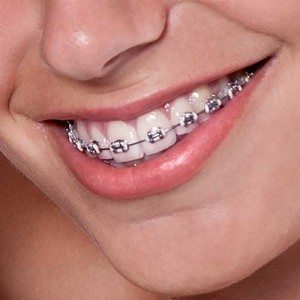 santa-clarita-orthodontist